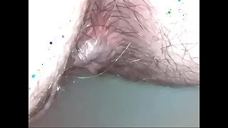 Fantastic Medicine roborant endoscope exploration be worthwhile for this sweaty and dirty ass hole